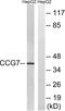 Calcium Voltage-Gated Channel Auxiliary Subunit Gamma 7 antibody, PA5-39528, Invitrogen Antibodies, Western Blot image 