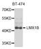 LIM homeobox transcription factor 1-beta antibody, STJ28469, St John