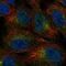 Dickkopf Like Acrosomal Protein 1 antibody, HPA047194, Atlas Antibodies, Immunofluorescence image 