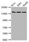 SF3b155 antibody, LS-C681307, Lifespan Biosciences, Western Blot image 