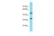 Abhydrolase Domain Containing 10 antibody, PA5-46200, Invitrogen Antibodies, Western Blot image 