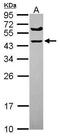 Tripartite Motif-Containing 51 antibody, GTX120369, GeneTex, Western Blot image 