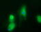 UDP-GlcNAc:betaGal beta-1,3-N-acetylglucosaminyltransferase 2 antibody, LS-C174258, Lifespan Biosciences, Immunofluorescence image 