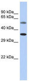 CAK antibody, TA329245, Origene, Western Blot image 