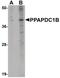 Phospholipid Phosphatase 5 antibody, PA5-20881, Invitrogen Antibodies, Western Blot image 