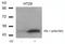ETS Transcription Factor ELK1 antibody, GTX50092, GeneTex, Western Blot image 