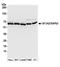 Splicing factor 3A subunit 2 antibody, A304-821A, Bethyl Labs, Western Blot image 