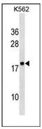 Ribosomal Protein Lateral Stalk Subunit P2 antibody, AP53727PU-N, Origene, Western Blot image 