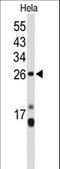Centromere Protein H antibody, LS-B14483, Lifespan Biosciences, Western Blot image 