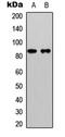 Catenin Beta 1 antibody, abx121372, Abbexa, Western Blot image 