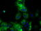 ATP Synthase F1 Subunit Beta antibody, TA500832, Origene, Immunofluorescence image 