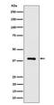 ACAT-2 antibody, M03245-2, Boster Biological Technology, Western Blot image 