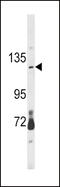 Protein CLEC16A antibody, 62-569, ProSci, Western Blot image 