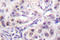 Heterogeneous Nuclear Ribonucleoprotein D antibody, LS-C176532, Lifespan Biosciences, Immunohistochemistry paraffin image 