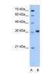 L-aminoadipate-semialdehyde dehydrogenase-phosphopantetheinyl transferase antibody, NBP1-54977, Novus Biologicals, Western Blot image 