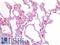Serine/Threonine Kinase 11 antibody, LS-B6669, Lifespan Biosciences, Immunohistochemistry paraffin image 