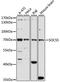 Suppressor of cytokine signaling 5 antibody, A7952, ABclonal Technology, Western Blot image 