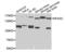 Neurofascin antibody, orb136801, Biorbyt, Western Blot image 