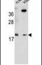 RING finger protein 185 antibody, PA5-24305, Invitrogen Antibodies, Western Blot image 