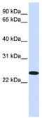 Zinc Finger DHHC-Type Containing 19 antibody, TA335991, Origene, Western Blot image 