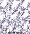 Phospholipase A And Acyltransferase 5 antibody, abx027667, Abbexa, Immunohistochemistry frozen image 