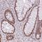 Zinc Finger RNA Binding Protein 2 antibody, NBP2-38766, Novus Biologicals, Immunohistochemistry paraffin image 