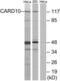 Caspase Recruitment Domain Family Member 10 antibody, LS-C119426, Lifespan Biosciences, Western Blot image 