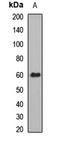 Ugt1 antibody, LS-C668628, Lifespan Biosciences, Western Blot image 