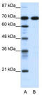 RNA polymerase I-specific transcription initiation factor RRN3 antibody, TA335516, Origene, Western Blot image 