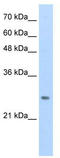 Homeobox protein Hox-B7 antibody, TA343468, Origene, Western Blot image 
