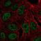 Zinc Finger Protein 283 antibody, NBP2-57438, Novus Biologicals, Immunocytochemistry image 