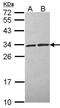 Calcyclin Binding Protein antibody, GTX104716, GeneTex, Western Blot image 