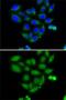 Zinc phosphodiesterase ELAC protein 2 antibody, GTX32582, GeneTex, Immunofluorescence image 