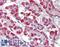 BAP antibody, LS-B4780, Lifespan Biosciences, Immunohistochemistry paraffin image 