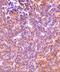 P21 (RAC1) Activated Kinase 2 antibody, A01419-2, Boster Biological Technology, Immunohistochemistry paraffin image 