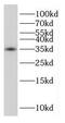Microtubule Associated Protein RP/EB Family Member 1 antibody, FNab02611, FineTest, Western Blot image 