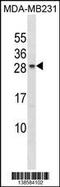 Charged Multivesicular Body Protein 5 antibody, 59-959, ProSci, Western Blot image 