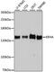 KIF4A antibody, GTX64498, GeneTex, Western Blot image 