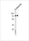 Alpha-L-Fucosidase 2 antibody, 63-094, ProSci, Western Blot image 