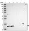 Coiled-Coil Domain Containing 150 antibody, NBP2-33514, Novus Biologicals, Western Blot image 