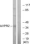 Arginine Vasopressin Receptor 2 antibody, LS-C120969, Lifespan Biosciences, Western Blot image 