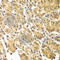 SMAD Family Member 3 antibody, A7536, ABclonal Technology, Immunohistochemistry paraffin image 