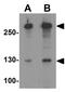 AT-Rich Interaction Domain 1A antibody, GTX31619, GeneTex, Western Blot image 