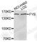FYN Binding Protein 1 antibody, A9906, ABclonal Technology, Western Blot image 