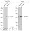 Ras Protein Specific Guanine Nucleotide Releasing Factor 1 antibody, GTX133775, GeneTex, Western Blot image 