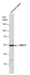 Prolargin antibody, PA5-78631, Invitrogen Antibodies, Western Blot image 