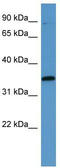 MAP kinase-activated protein kinase 3 antibody, TA342910, Origene, Western Blot image 