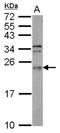 ADP Ribosylation Factor Like GTPase 3 antibody, NBP2-15464, Novus Biologicals, Western Blot image 