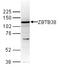 Zinc Finger And BTB Domain Containing 38 antibody, TA347316, Origene, Western Blot image 