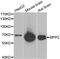 Membrane Palmitoylated Protein 2 antibody, abx005105, Abbexa, Western Blot image 